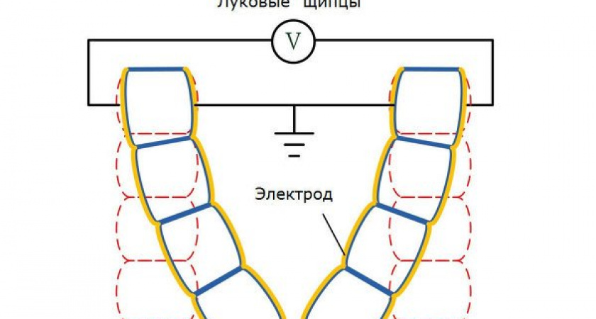 Физики создали искусственные мускулы из клеток лука и золота