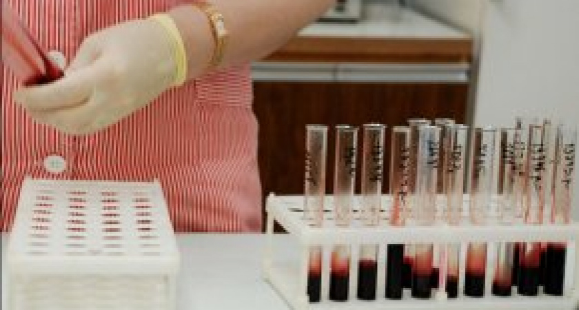 Проблема распространения ВИЧ требует пристального внимания властей и общества