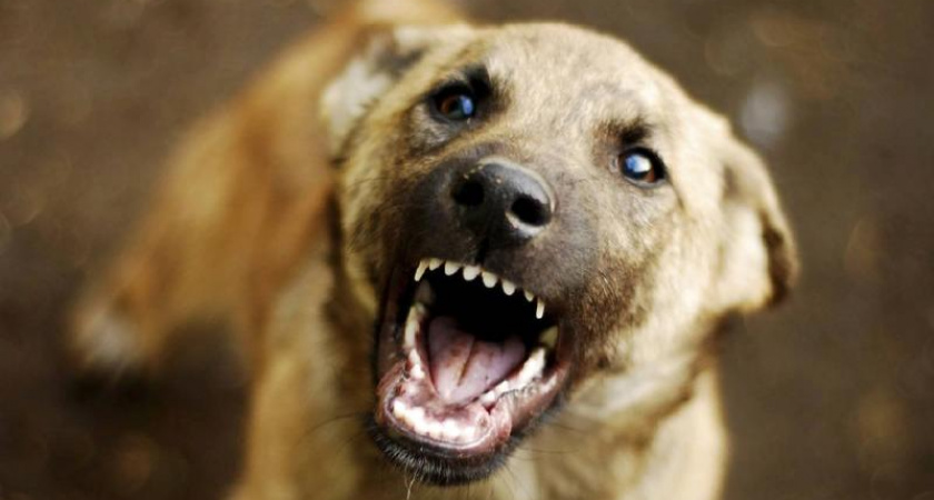 Собаки загрызли ребенка насмерть.