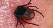 Каждый 85-ый укушенный клещом житель Иркутской области госпитализирован 